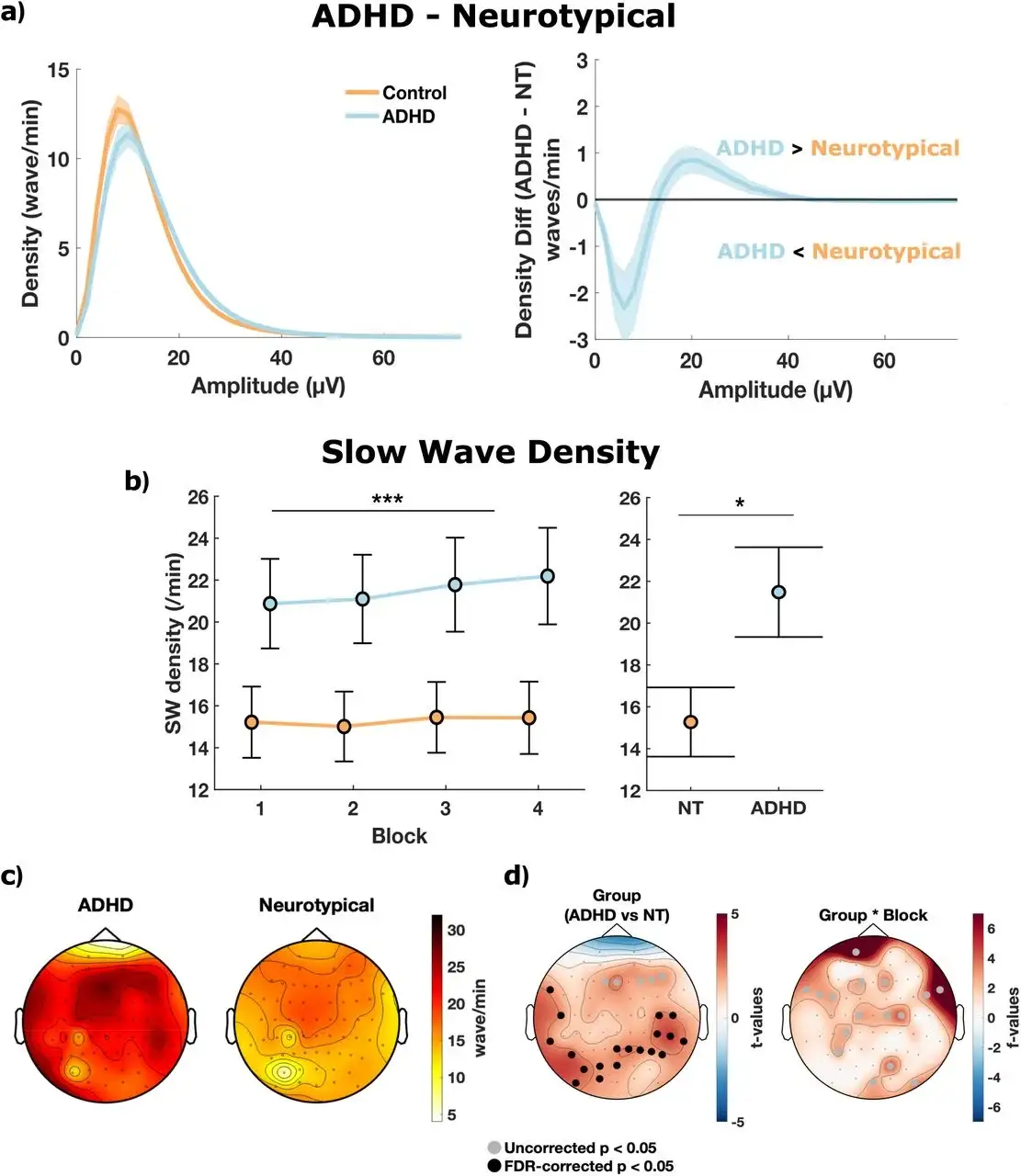 Мозг засыпает от скуки — и учёные наконец это доказали